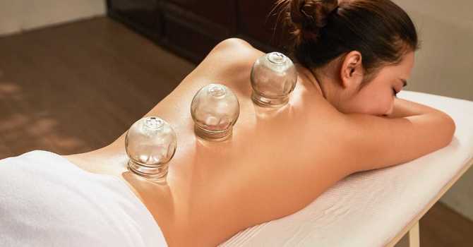 Cupping